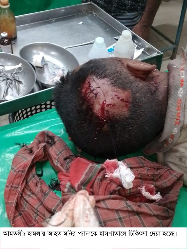 আমতলীতে বাইপাস রাস্তা সংস্কারকে কেন্দ্র করে সংঘর্ষে আহত ১০